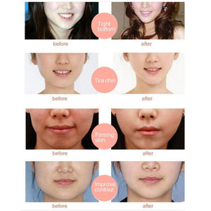 Miracle V-Shaped Slimming Mask