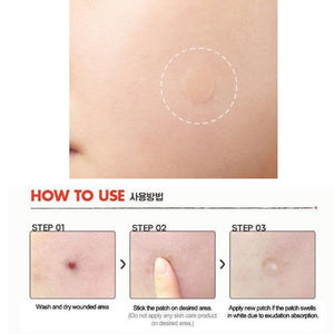 Pimple Remover Patch (15pcs)