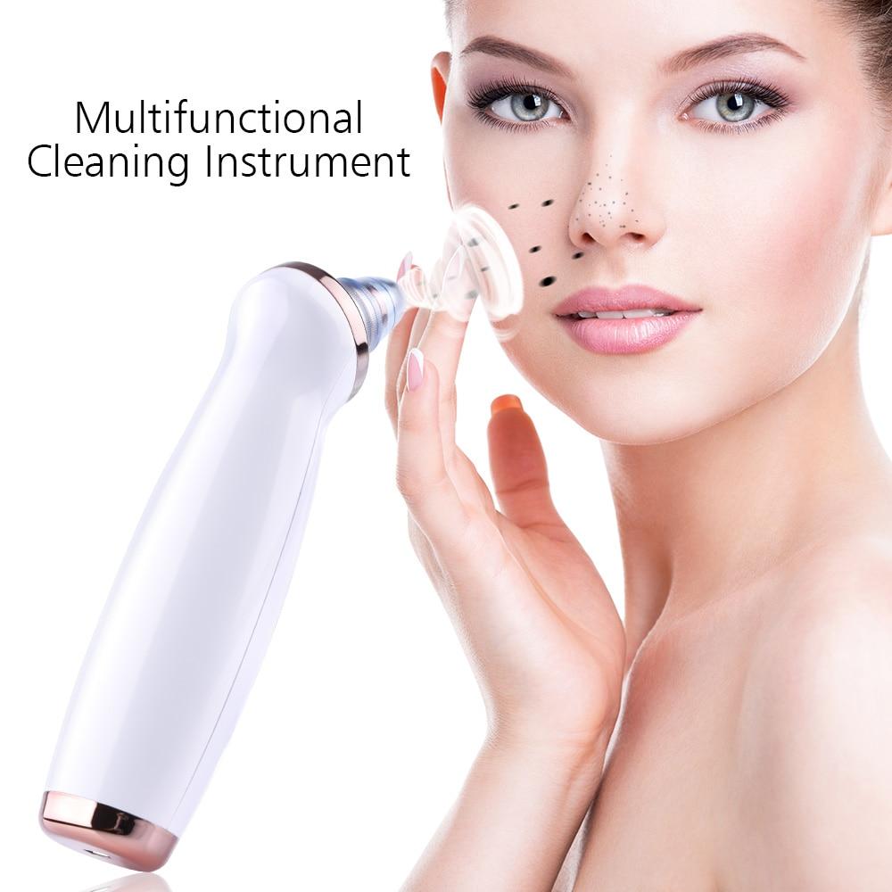 Blackhead Remover