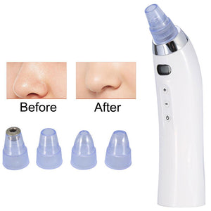 Blackhead Vacuum Cleanser